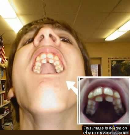 Hampaita muutama liikaa