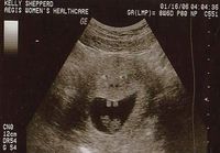 one happy ultrasound