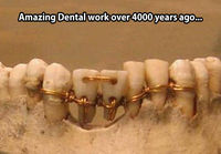 4000 vuotta sitten hoidetut hampaat