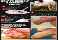 Kuinka kasvatat irronneen sormen takaisin