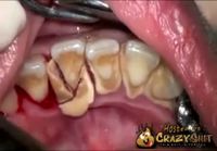 Nautinnollinen hammaslääkärivideo
