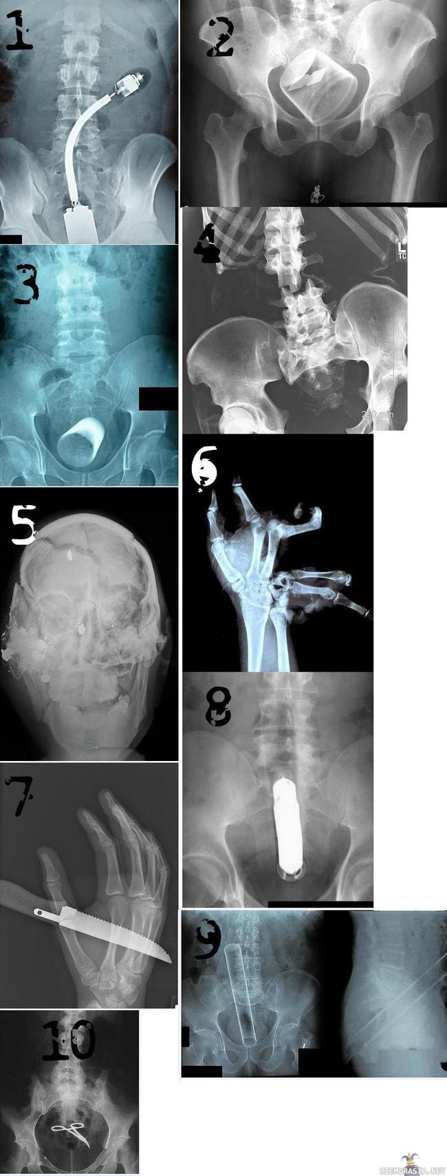 X ray - Jännää