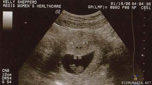 one happy ultrasound