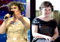 Susan Boyle ennen ja jälkeen
