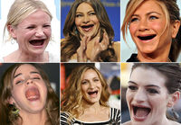 celebs without teeth
