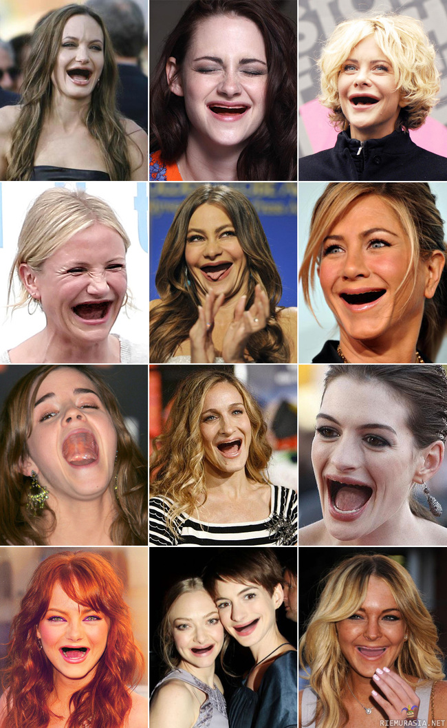 celebs without teeth