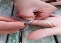 Miten poistaa jumiutunut sormus sormesta